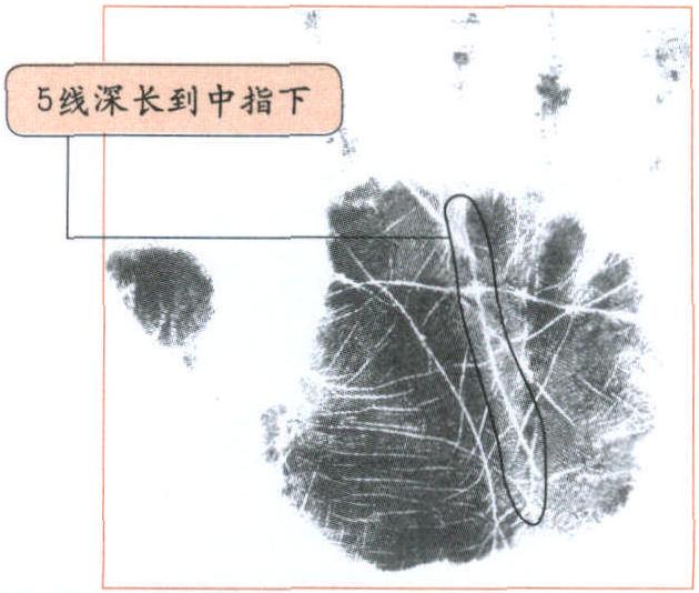 預(yù)見中老年心腦血管疾病——5線